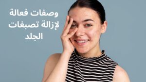 Read more about the article وصفة للتخلص من التصبغات