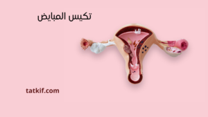 Read more about the article متلازمة تكيس المبايض : أعراضها، أسبابها والطرق الناجعة لعلاجها