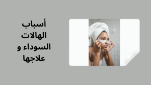 Read more about the article أسباب الهالات السوداء و علاجها، تعرف على طرق إزالتها بسرعة